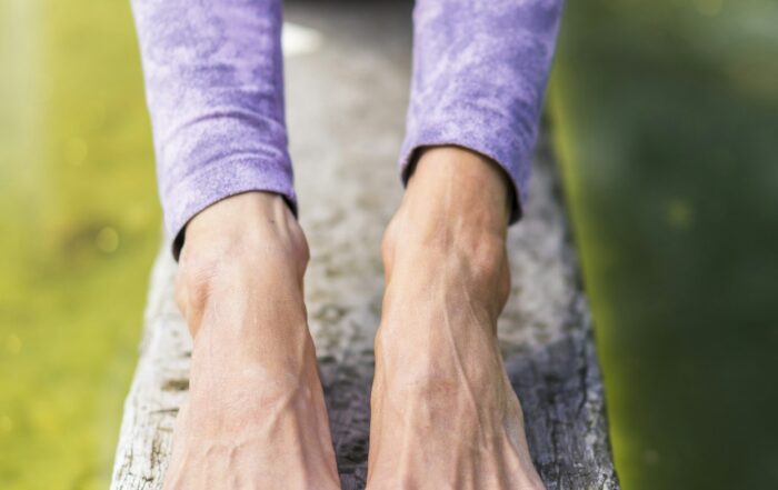 signs of poor circulation in legs