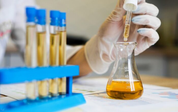 trichomoniasis urine test female