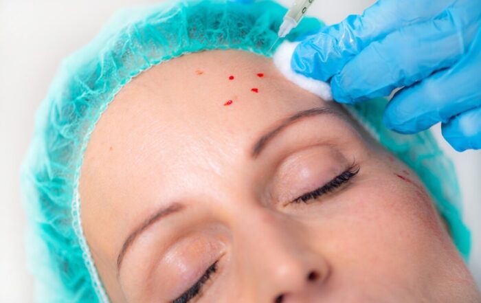 injectable psoriasis treatment