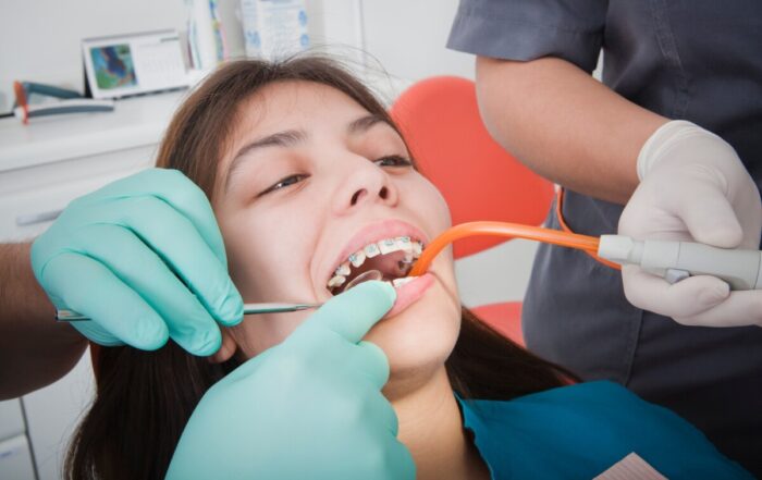 marketplace dental insurance