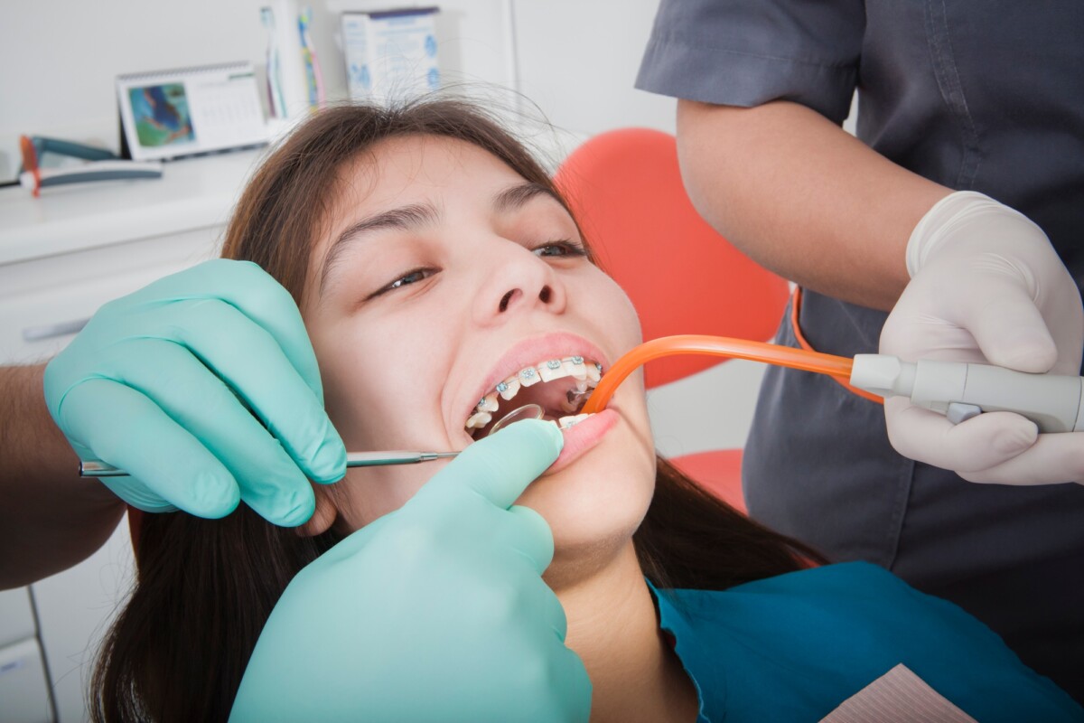 marketplace dental insurance
