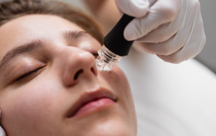 microneedling kansas city cost