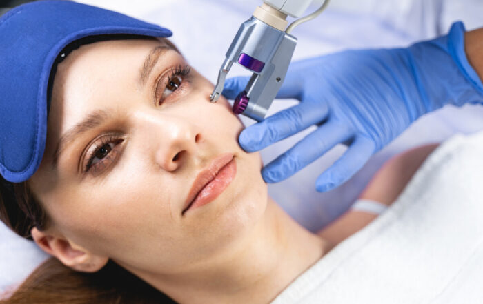 kaiser dermatology microneedling