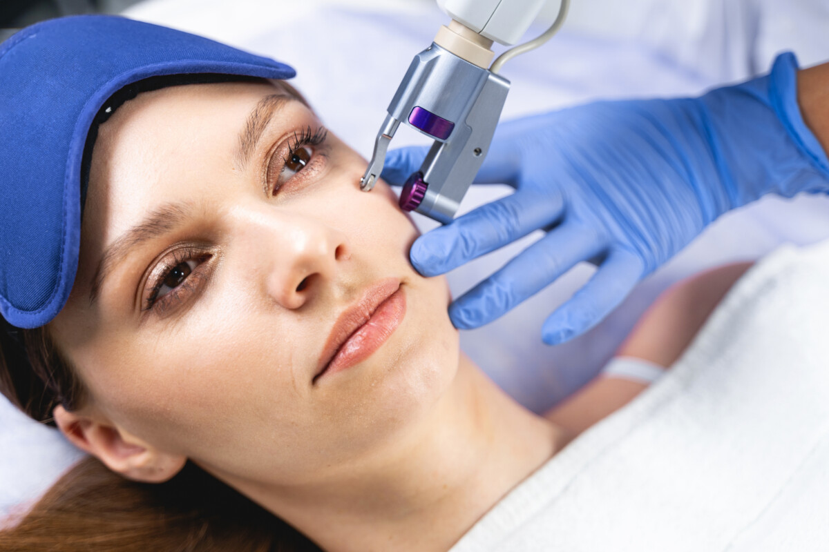 kaiser dermatology microneedling
