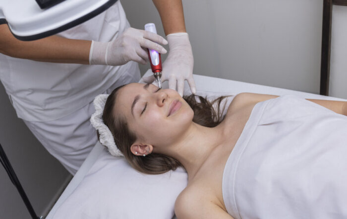 does kaiser do microneedling