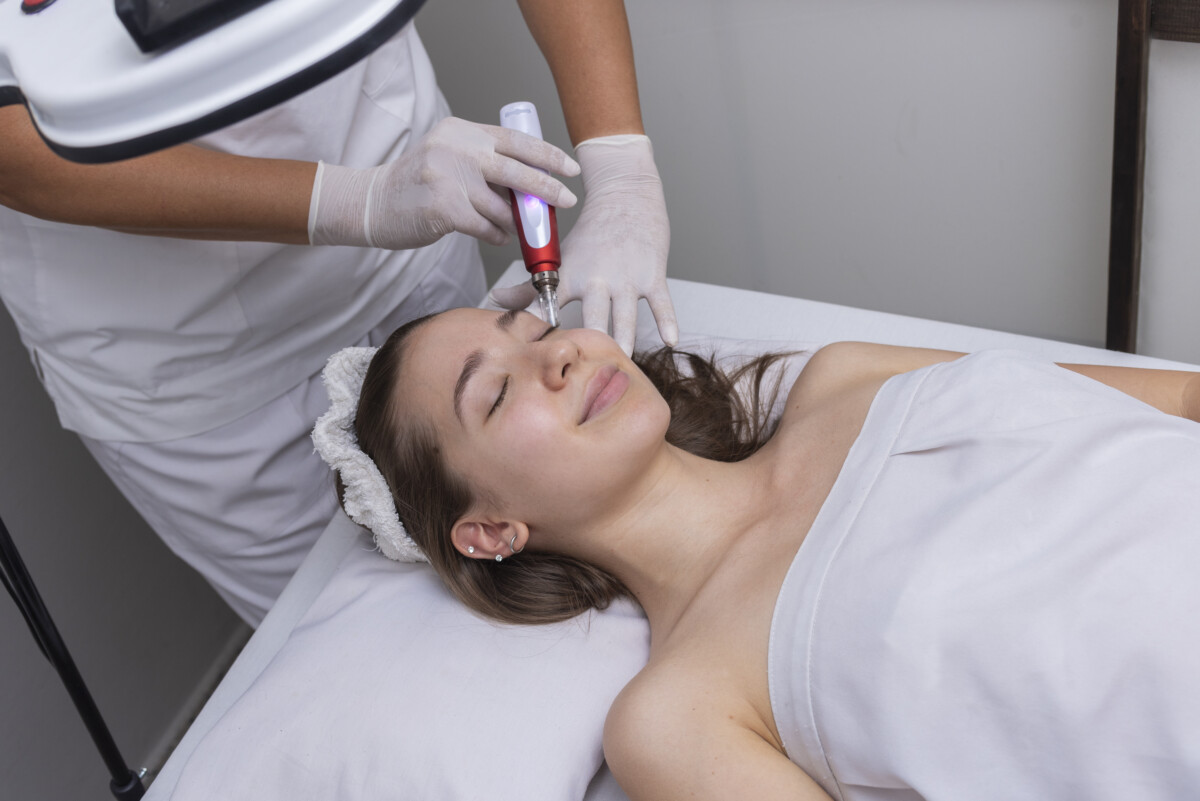 does kaiser do microneedling